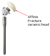 affinis ceramic head implant