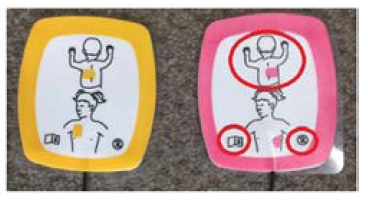 image showing the incorrect use of defibrillator..